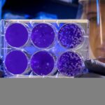 En conclusion le Coronavirus ne s’attaque qu’aux faibles